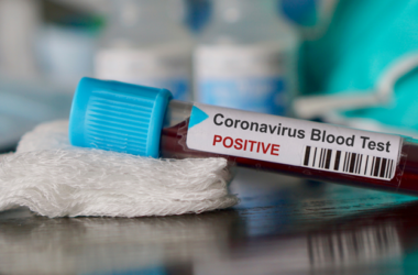 Se trata del primer caso confirmado de un latinoamericano diagnosticado con el nuevo coronavirus que se haya anunciado hasta el momento.