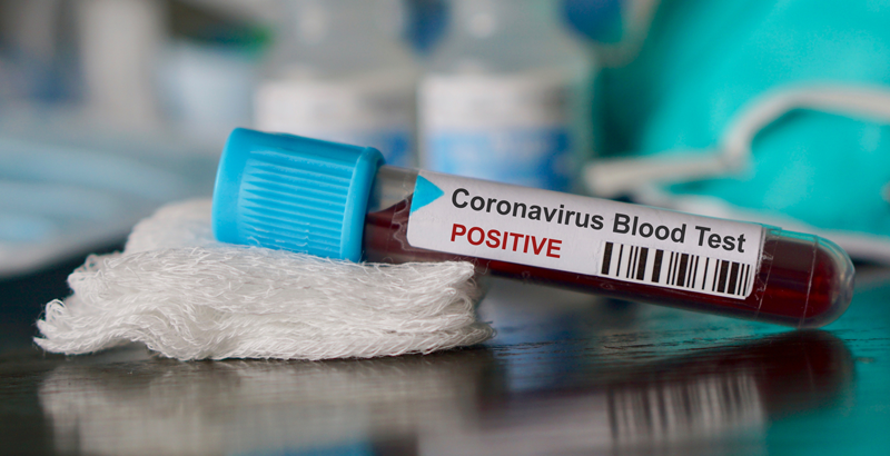 Se trata del primer caso confirmado de un latinoamericano diagnosticado con el nuevo coronavirus que se haya anunciado hasta el momento.