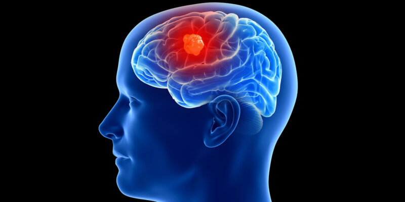 “La ironía es que uno de los virus más mortales del mundo puede ser útil para tratar uno de los cánceres cerebrales más mortales”
